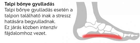 Talpi bőnye gyullad&aacute;s