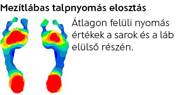 Talpnyomas1.png
